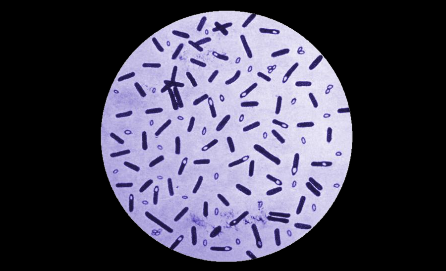 Staphylococcus aureus (Gram stain)