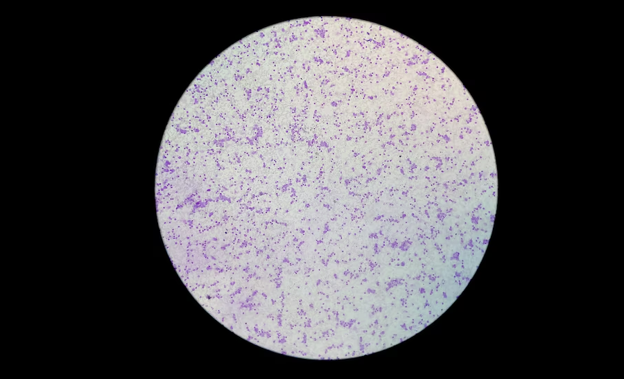 Staphylococcus aureus (Gram stain)